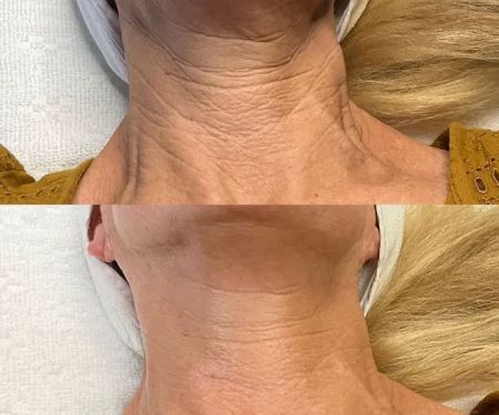 Ashley Sigdestad - Esthetician