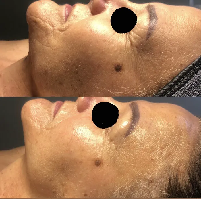 Ashley Sigdestad - Esthetician Picture 7