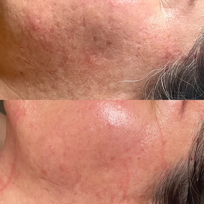 Ashley Sigdestad - Esthetician Picture 4