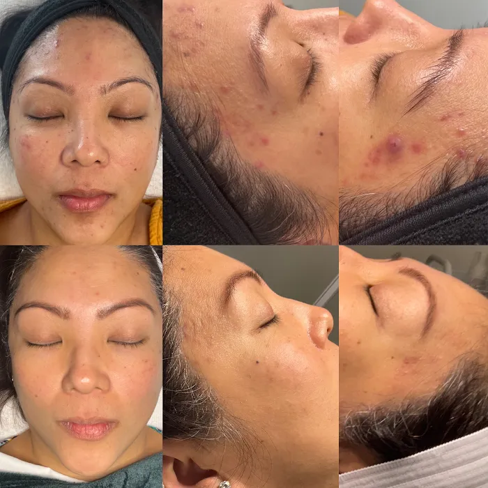 Ashley Sigdestad - Esthetician Picture 10