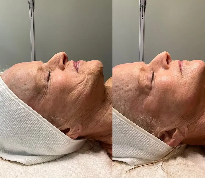 Ashley Sigdestad - Esthetician Picture 8