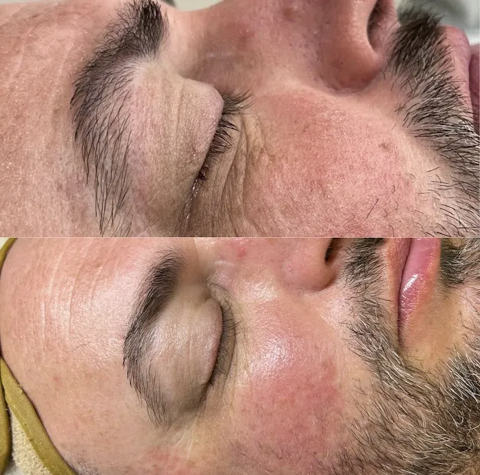 Charm Esthetics Skin Care Picture 7