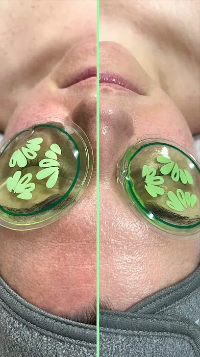 Charm Esthetics Skin Care Picture 10