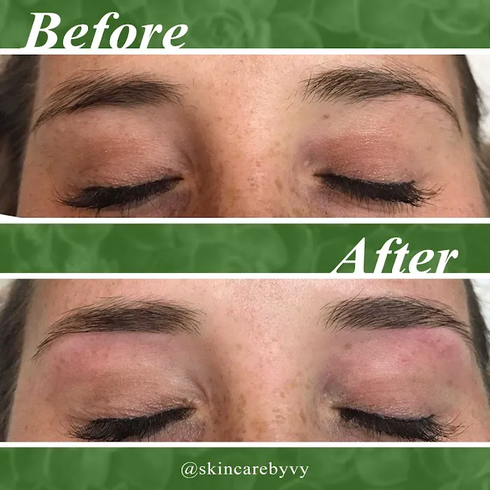 Skincare By Vy Picture 2