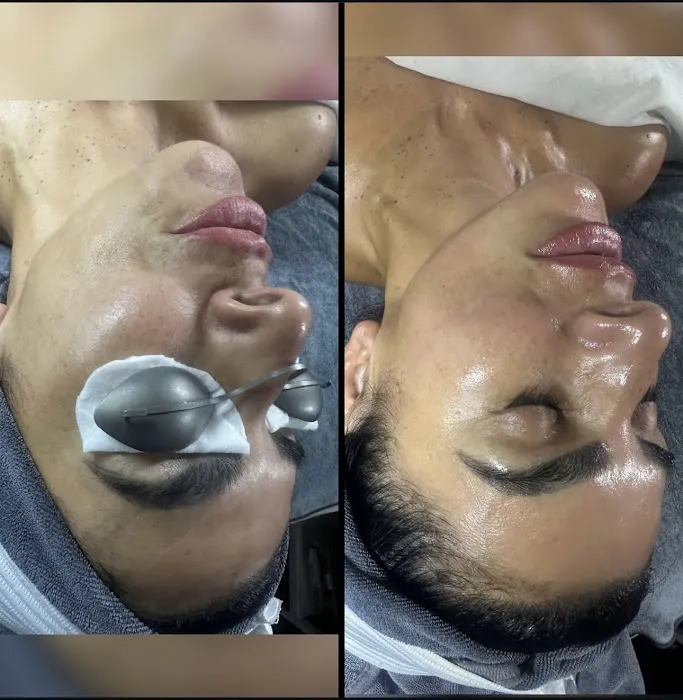 SkinBar Del Mar Picture 7