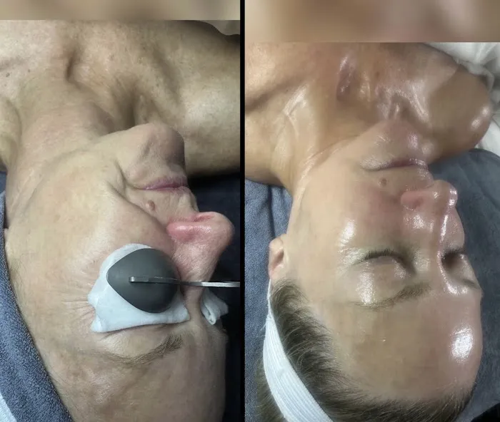 SkinBar Del Mar Picture 8