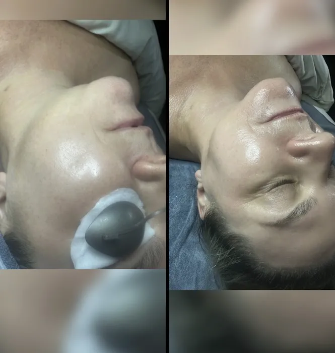 SkinBar Del Mar Picture 2