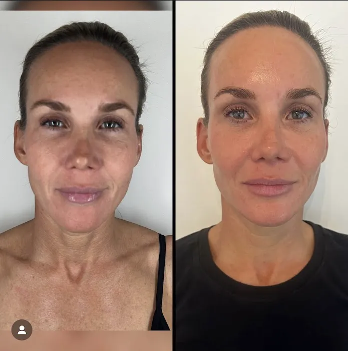 SkinBar Del Mar Picture 9