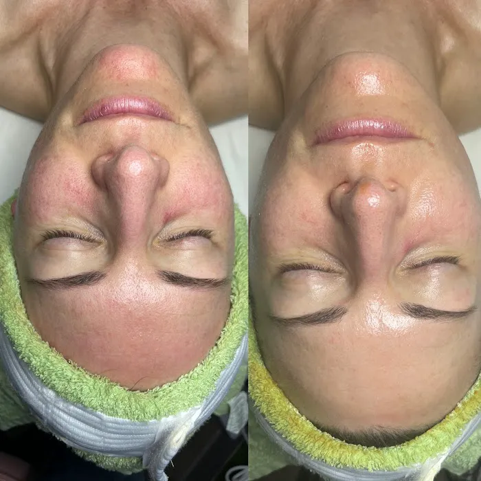 Skin Beautyq Picture 5