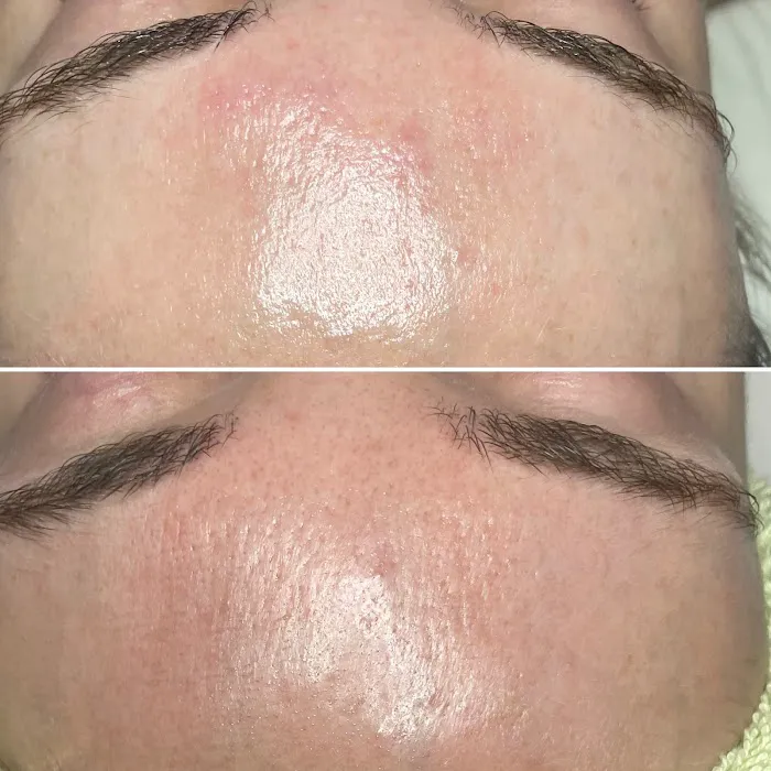 Skin Beautyq Picture 7