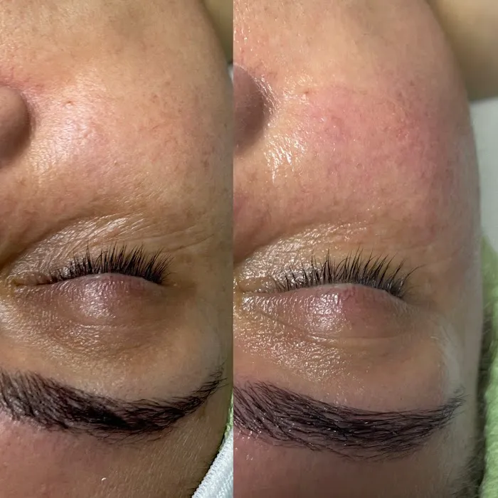 Skin Beautyq Picture 1