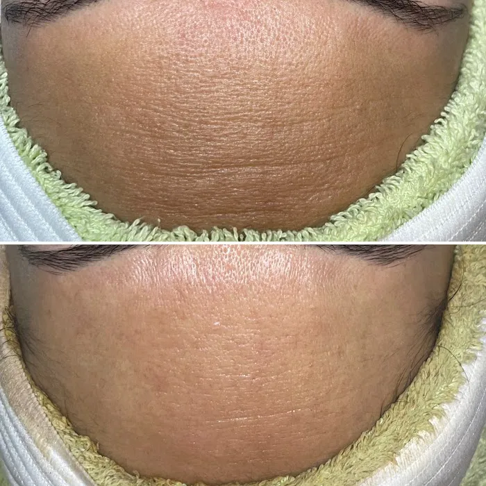 Skin Beautyq Picture 4