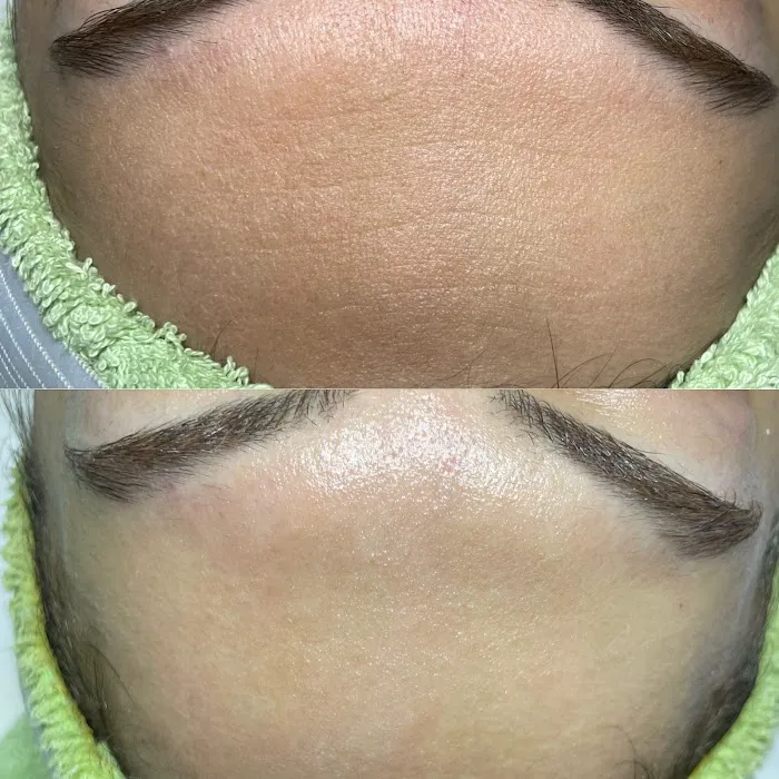 Skin Beautyq Picture 9