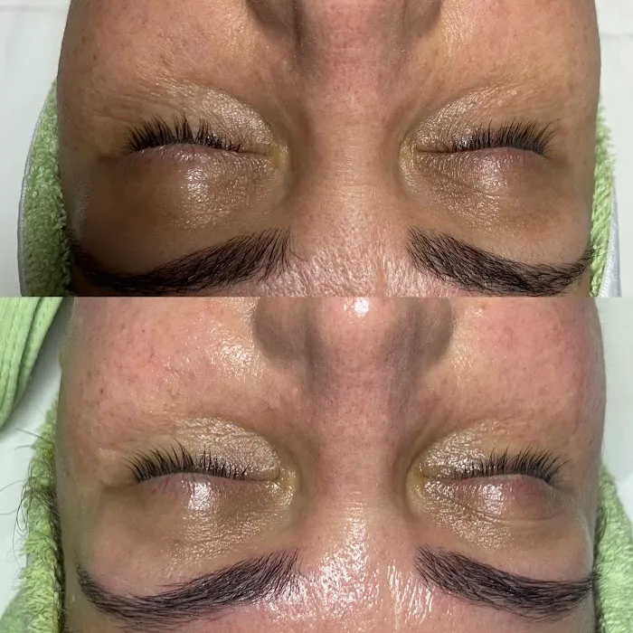 Skin Beautyq Picture 8