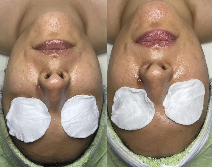 Skin Beautyq Picture 10