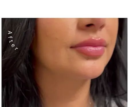 SoCal Skin Aesthetics