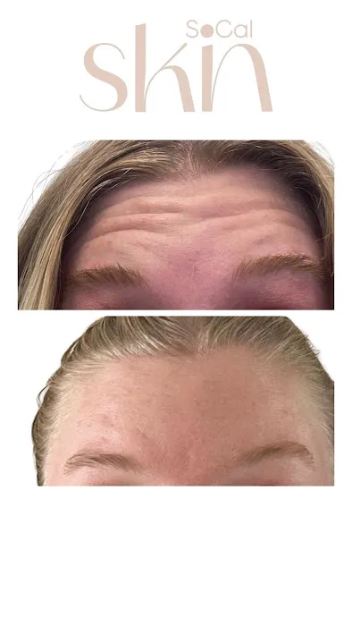 SoCal Skin Aesthetics Picture 2