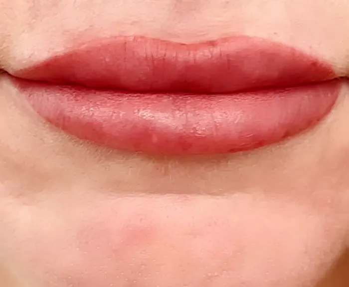 The Skinstitute of San Diego (Scar + Stretch Mark Clinic) Picture 7