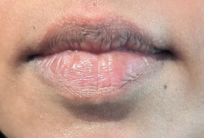 The Skinstitute of San Diego (Scar + Stretch Mark Clinic) Picture 2