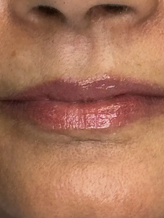 The Skinstitute of San Diego (Scar + Stretch Mark Clinic) Picture 9