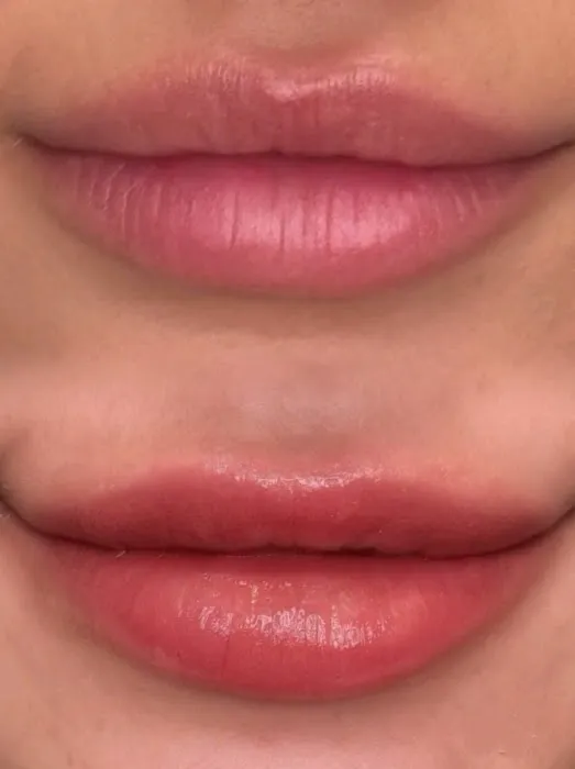 The Skinstitute of San Diego (Scar + Stretch Mark Clinic) Picture 8