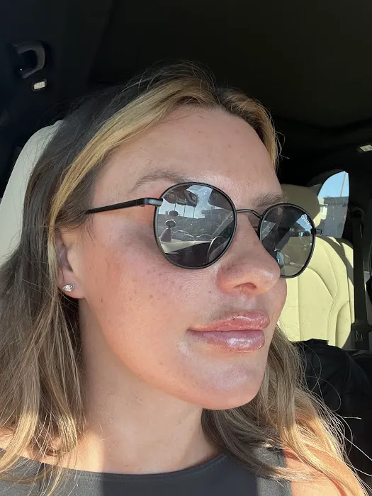 PREVA Aesthetics Picture 2