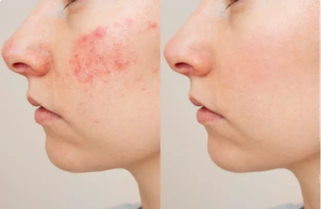 West Point Aesthetic Center Picture 4