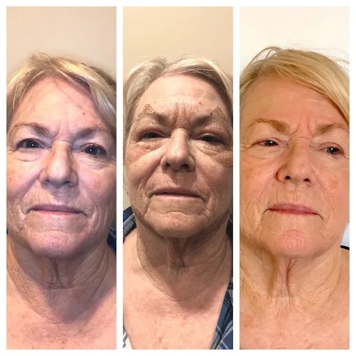 JLuxe Skin Picture 8