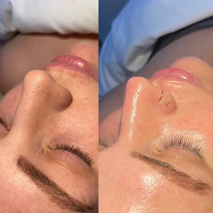 Moon Lux Skin & Wellness Picture 10