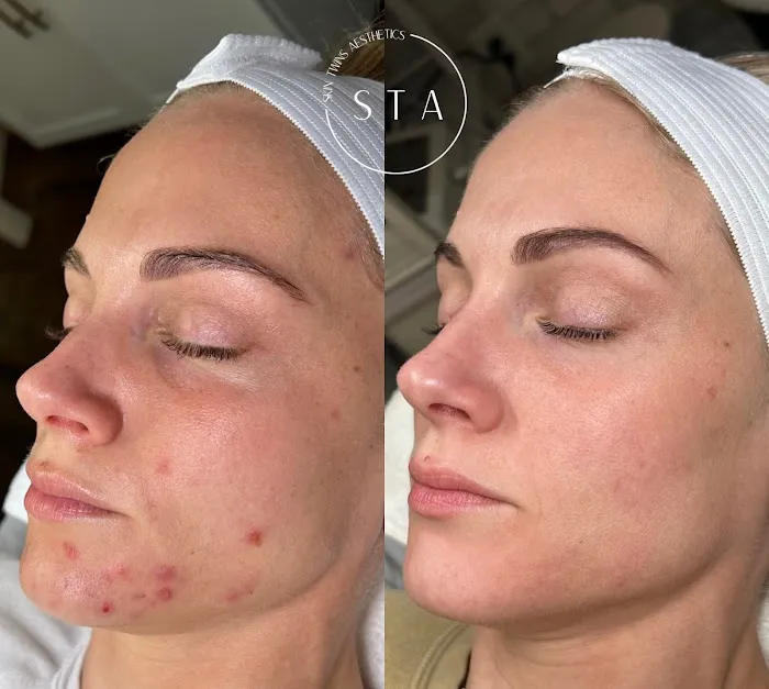 Skin Twins Aesthetics Picture 4