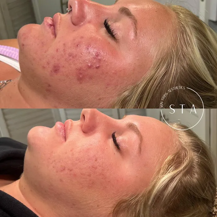 Skin Twins Aesthetics Picture 9