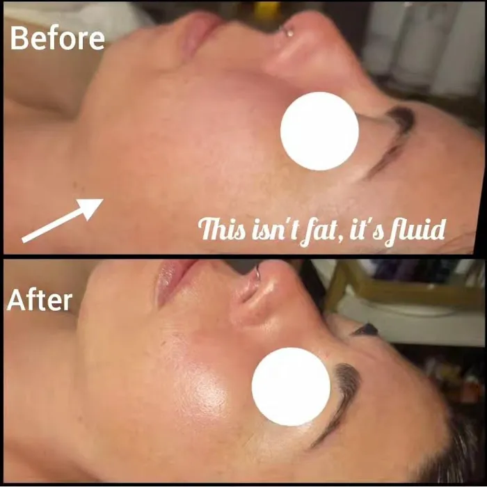 Infusion Skincare Picture 1