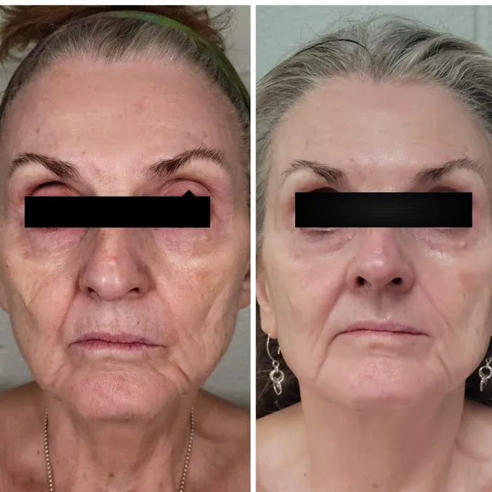 Infusion Skincare Picture 5