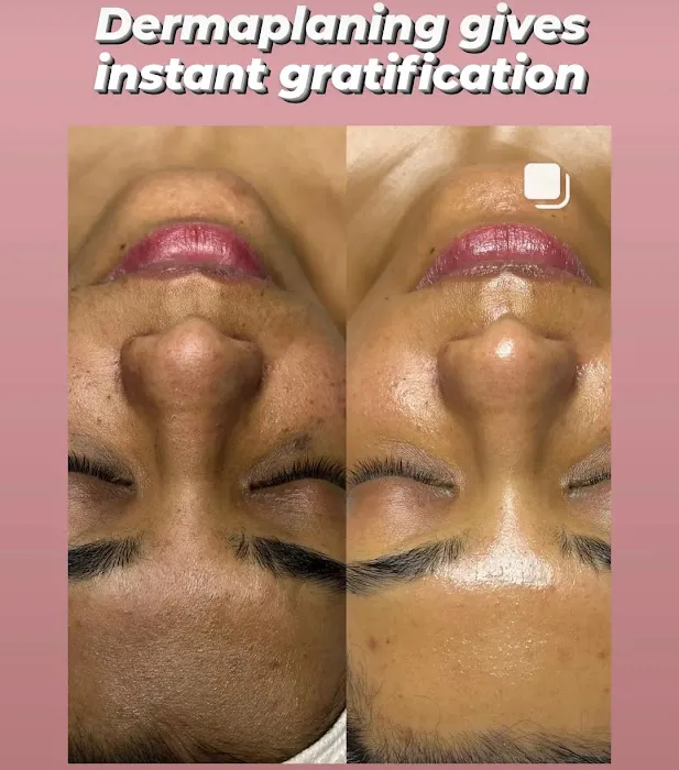 Infusion Skincare Picture 10