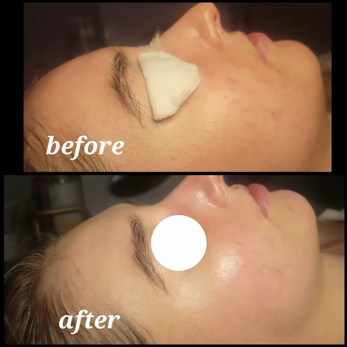 Infusion Skincare Picture 7