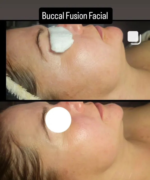 Infusion Skincare Picture 9