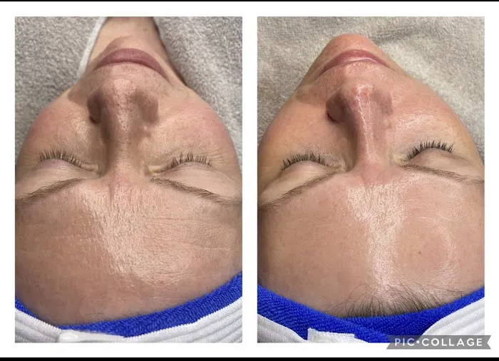 Beauty Epitome Picture 5