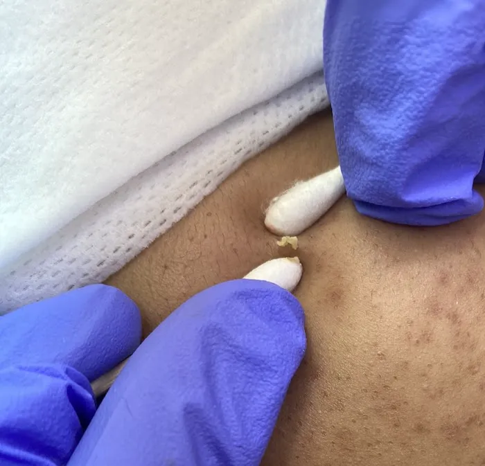 Beauty Epitome Picture 2