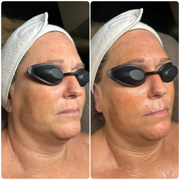 Highline Esthetics Picture 10