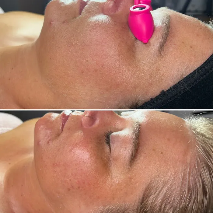 Miranda Hummel Artistry Picture 8