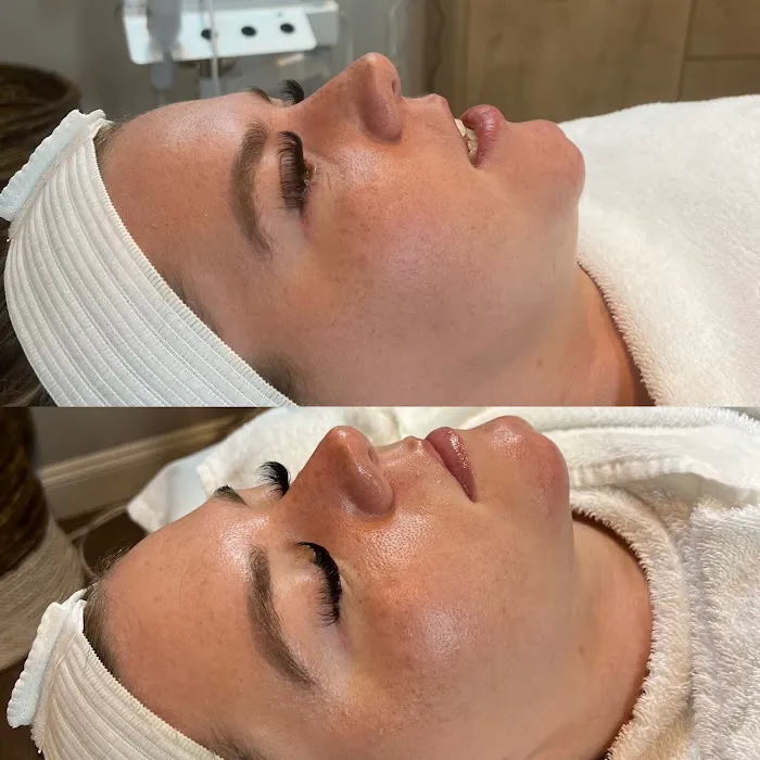 Beauty Within The Skin Picture 8