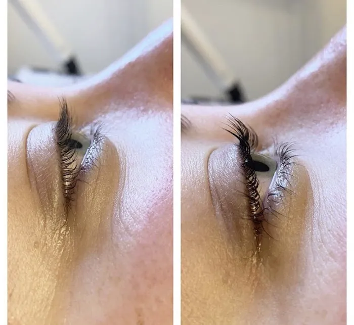 Kel Aesthetics Picture 8