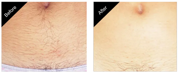 The New You Esthetics Picture 9