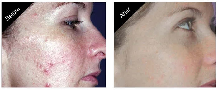 The New You Esthetics Picture 10