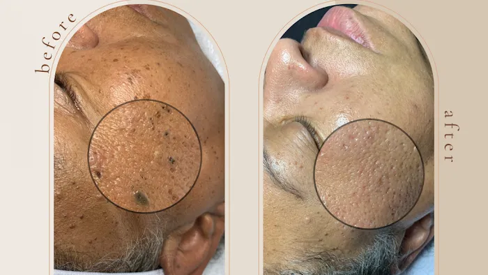 Skintentions Picture 4