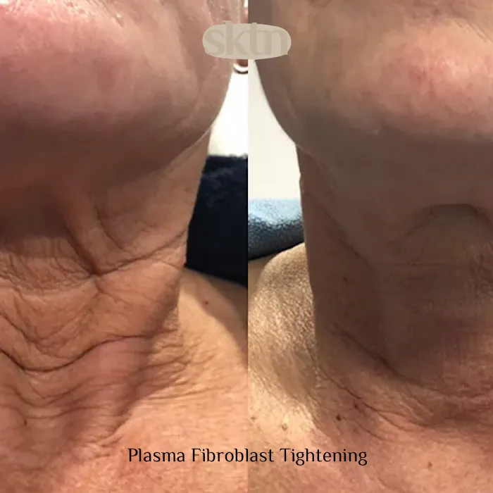 Skintentions Picture 6