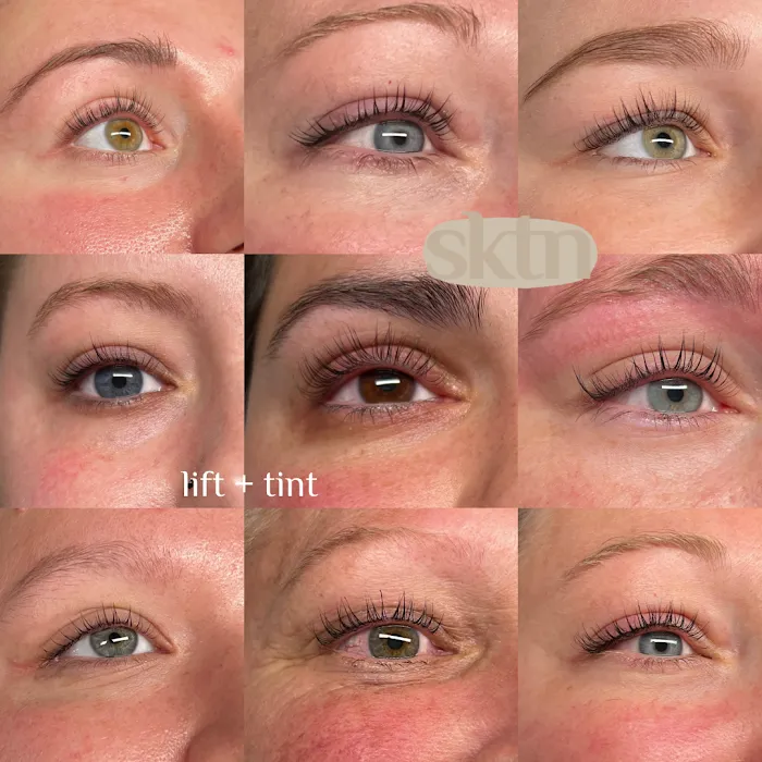 Skintentions Picture 8