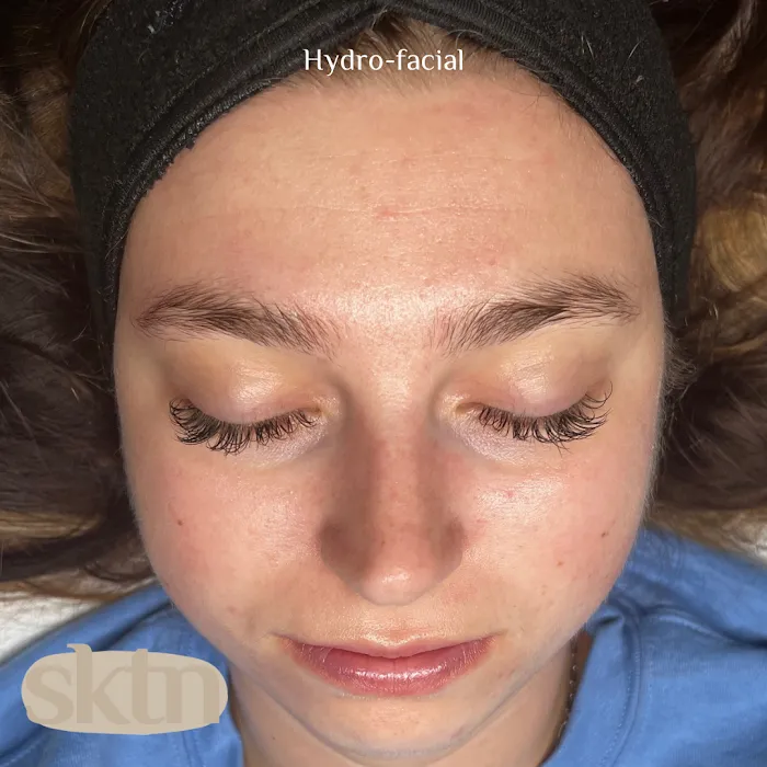 Skintentions Picture 7