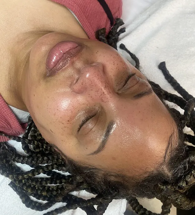 Blushing Esthetics Picture 8