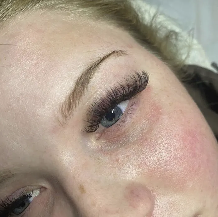 Blushing Esthetics Picture 7